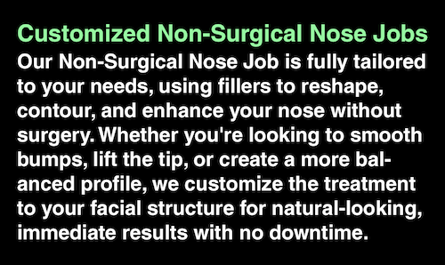 non surgical nose job info oakville mississauga etobicoke